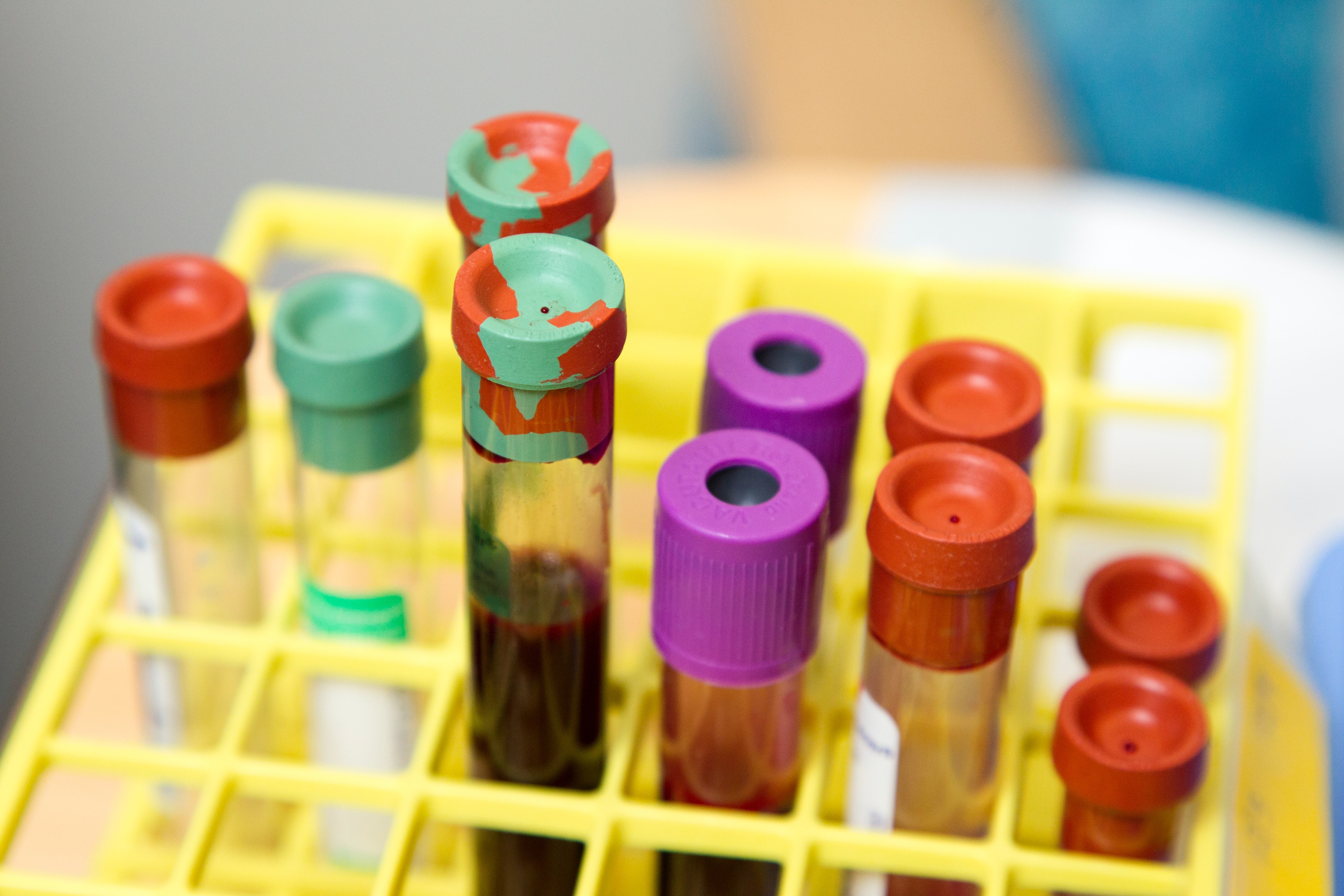 blood samples in a tray